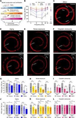 Integrative Functional Transcriptomic Analyses Implicate Shared Molecular Circuits in Sensorineural Hearing Loss